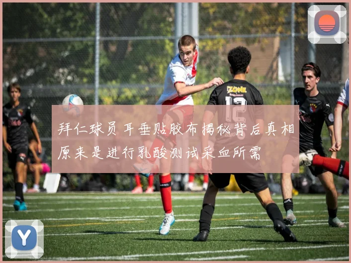 拜仁球员耳垂贴胶布揭秘背后真相原来是进行乳酸测试采血所需